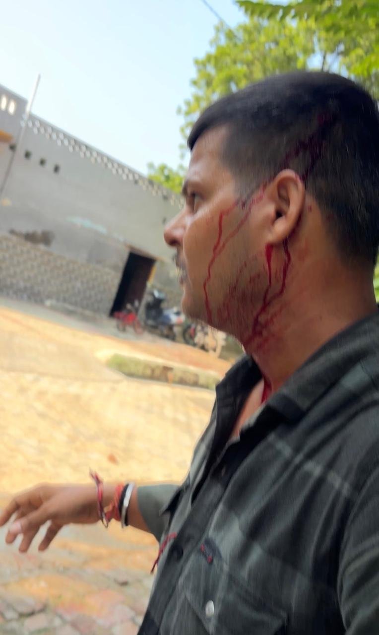 खेत की तारबंदी को लेकर विवाद, तीन लोग घायल; महिला से अभद्रता का आरोप