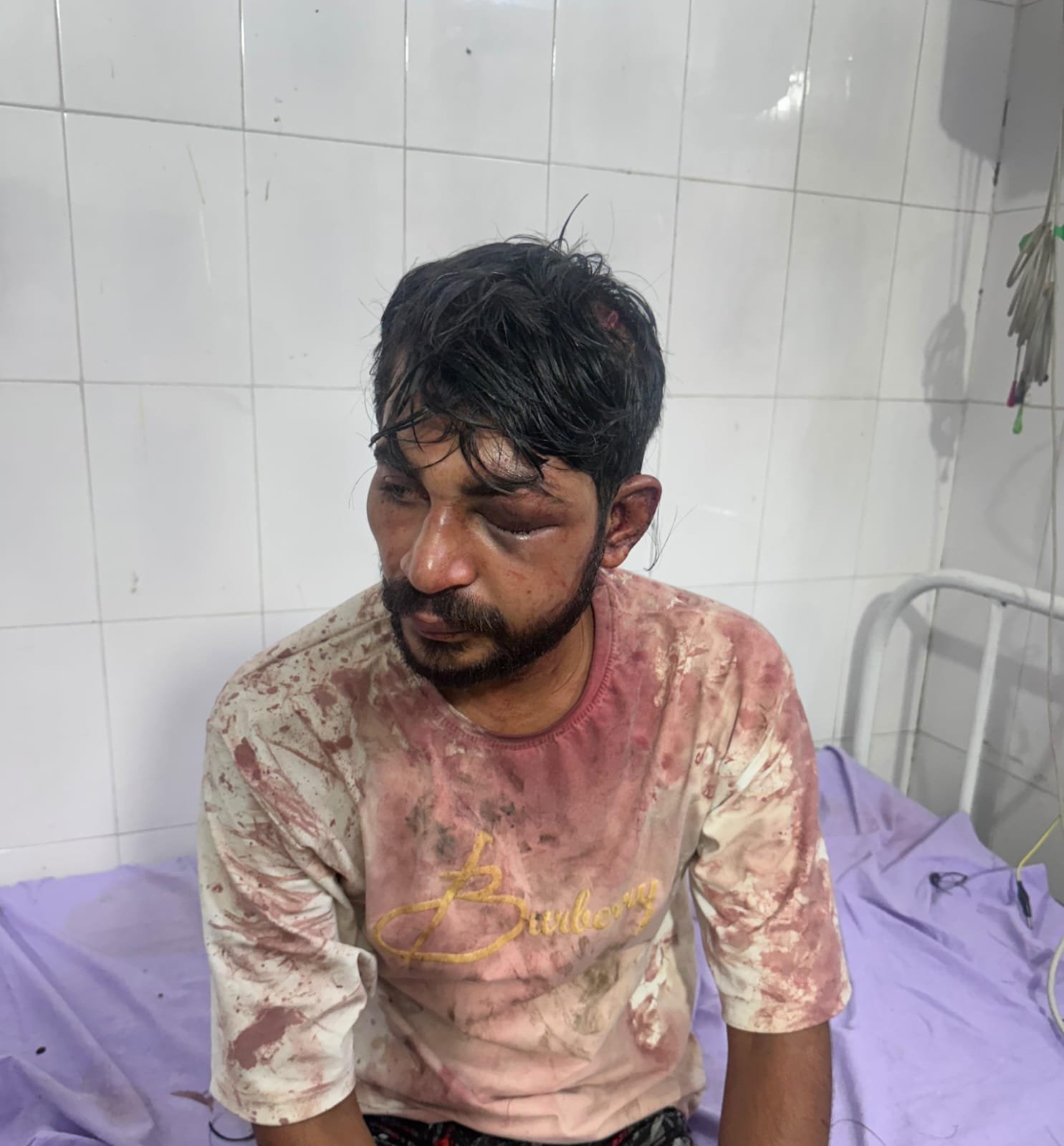 अपहरण कर युवक की बेरहमी से पिटाई, आंख और पैर में गंभीर चोटें; मेरठ मेडिकल में भर्ती